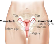 yumurtalik_kanseri1